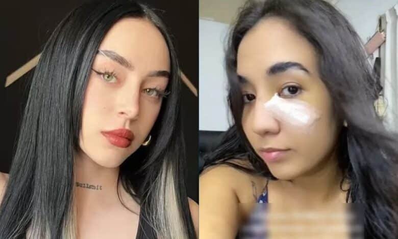 Video: Fan de Nicki Nicole relata como termina en el hospital tras botellazo