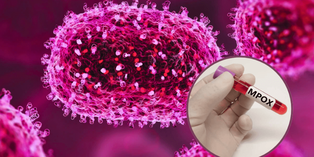 ¡Alerta! Veracruz registra primer caso de Mpox