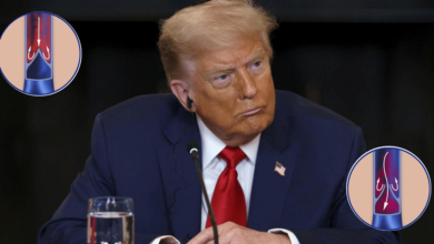 Trump enfrenta problemas venosos a los 79 años, confirma la Casa Blanca