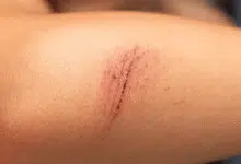 Muerte por rabia en Veracruz ocurrió en 2025, confirma Rocío Nahle