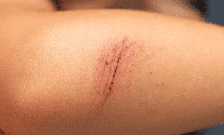 Muerte por rabia en Veracruz ocurrió en 2025, confirma Rocío Nahle