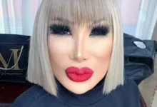 lyn may revela cómo vivió el cambio en su rostro